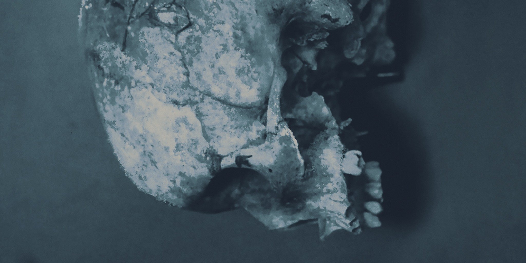 Series photo