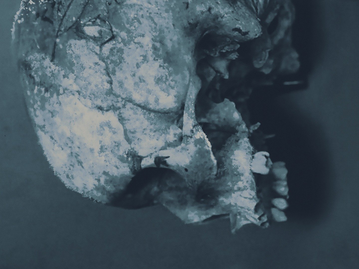 Series photo
