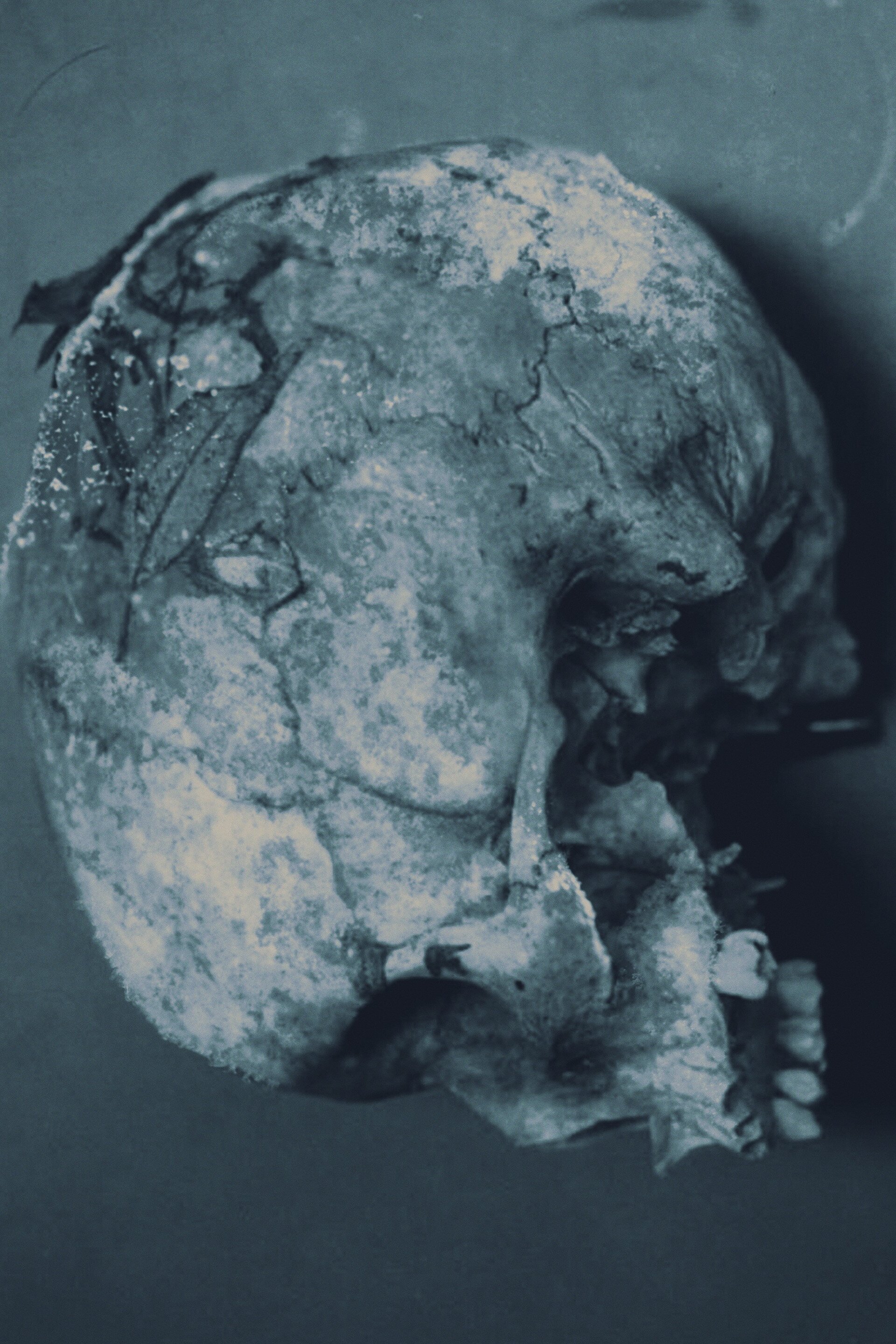 Series photo