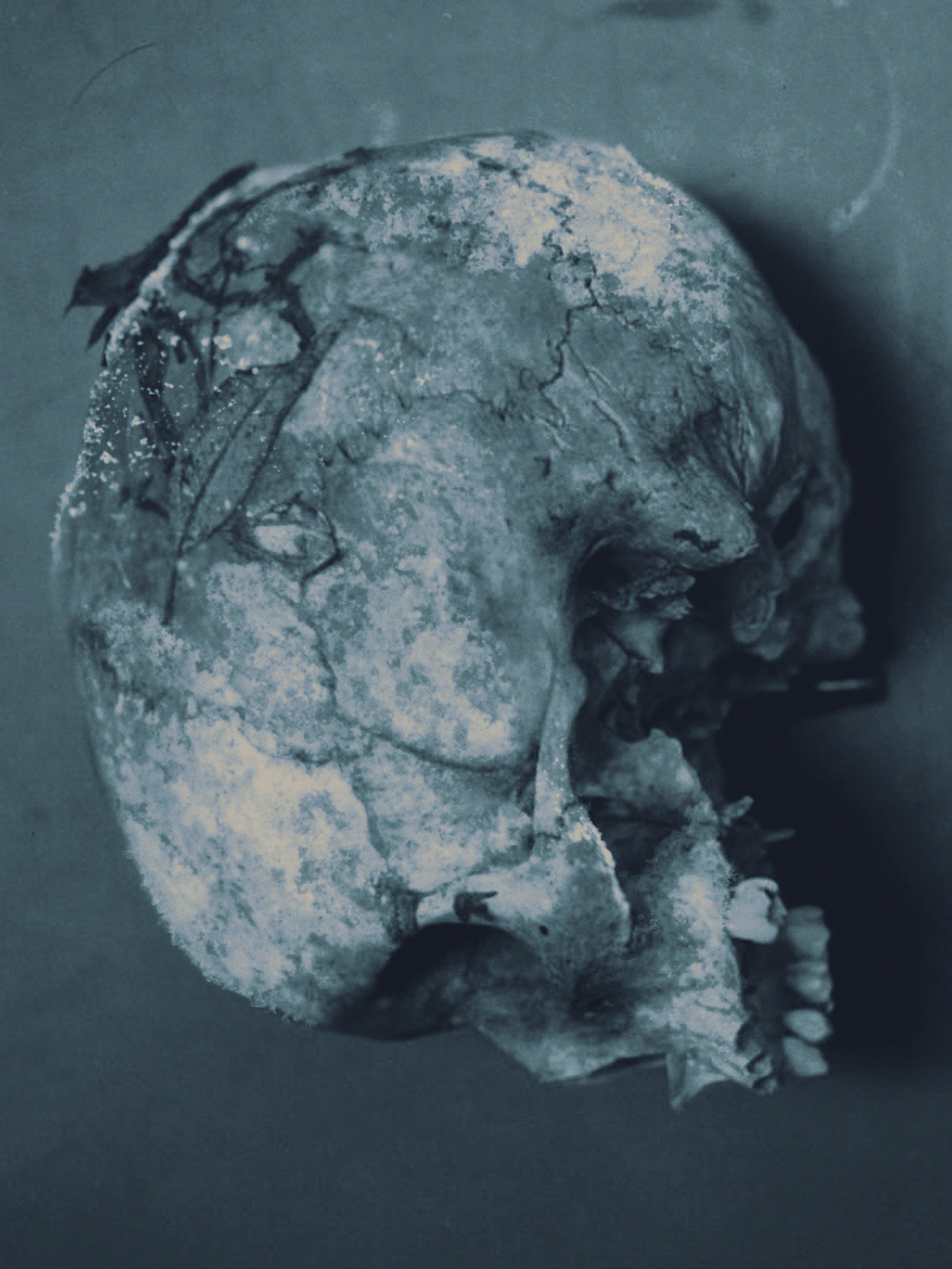 Series photo