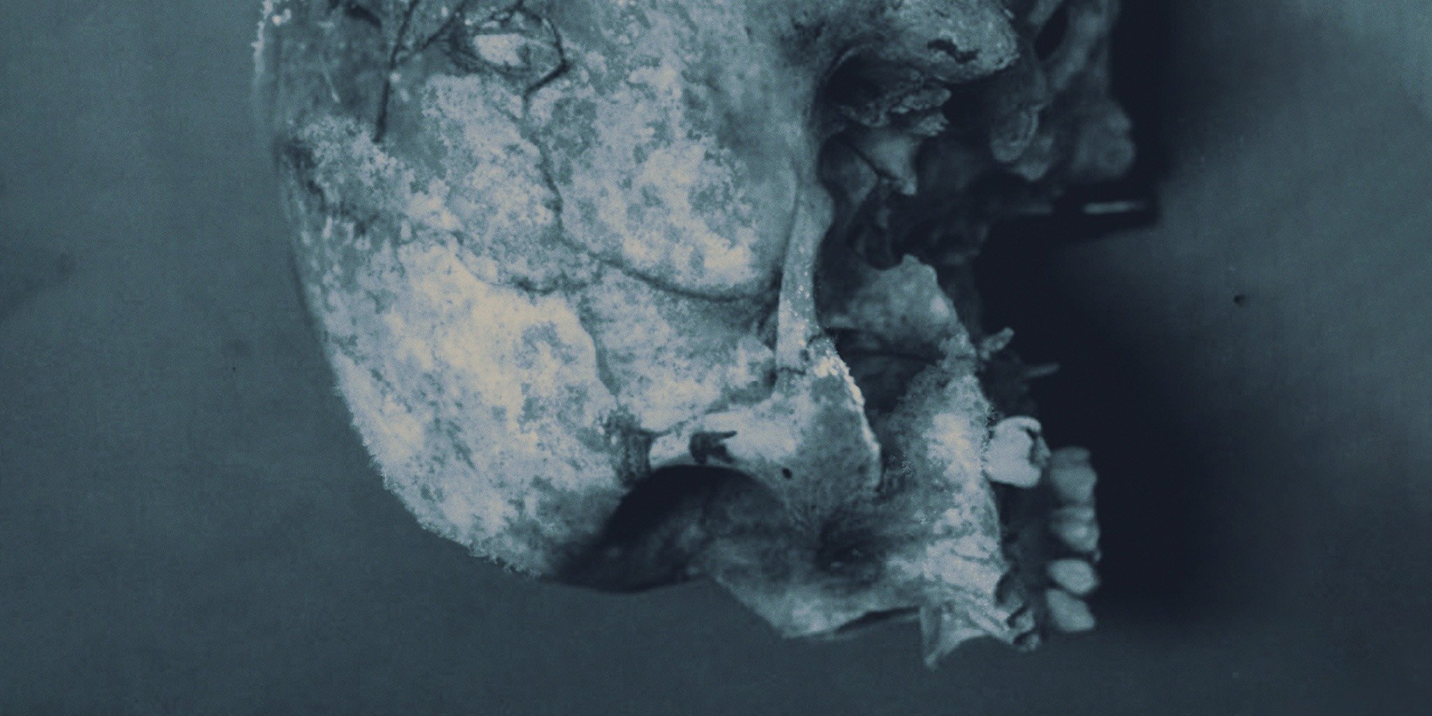 Series photo
