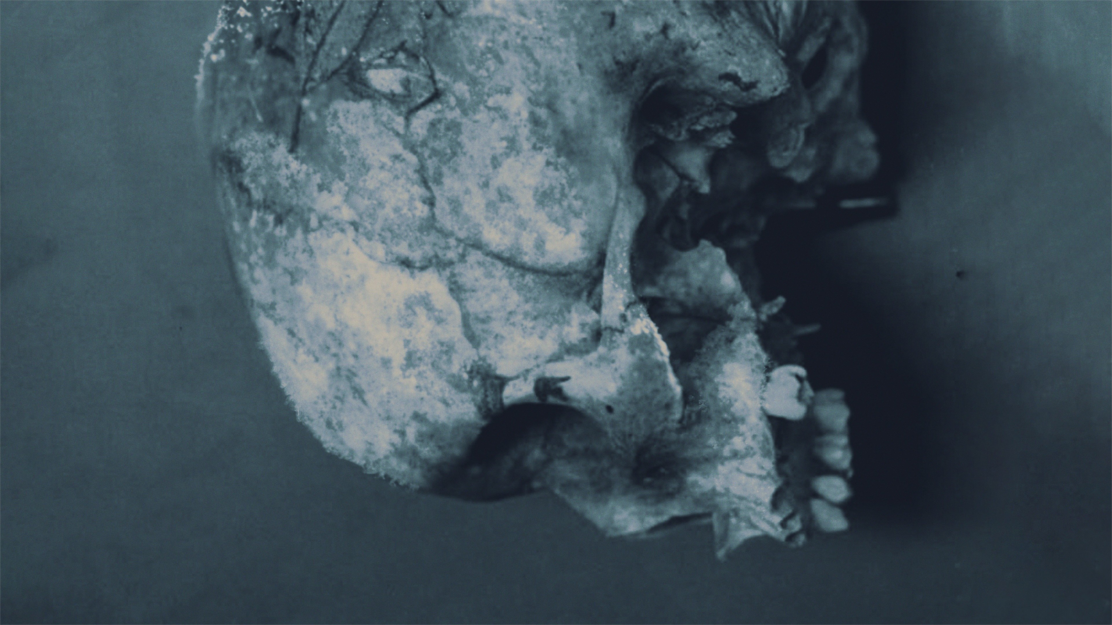 Series photo