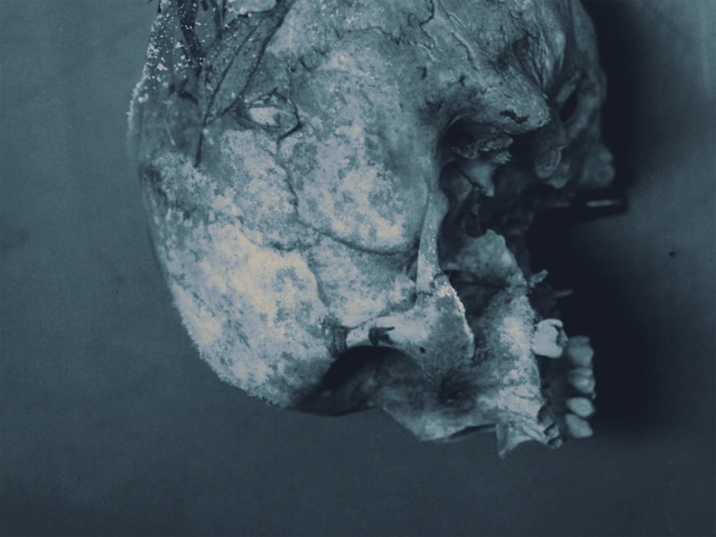 Series photo