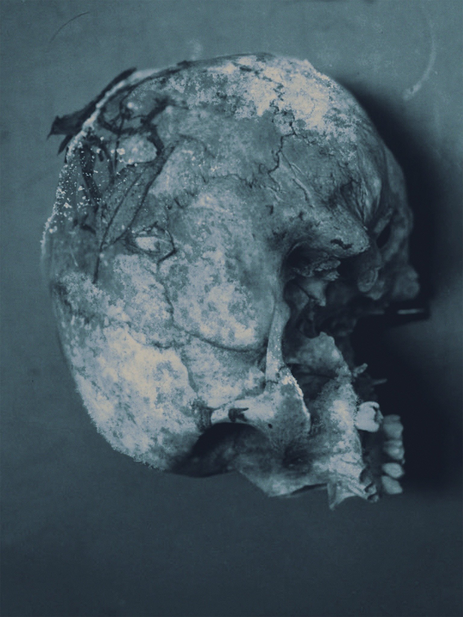 Series photo