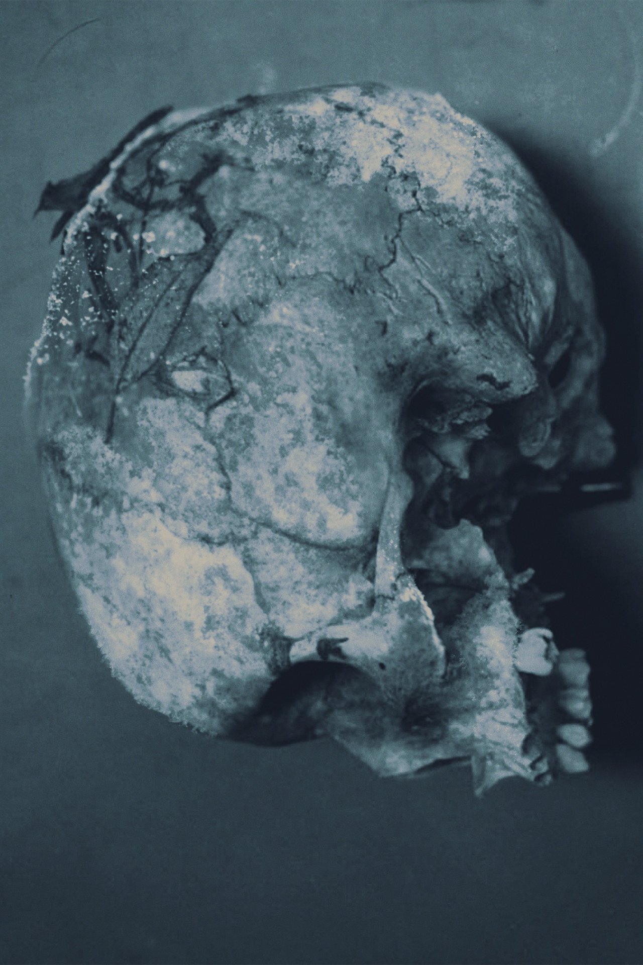 Series photo