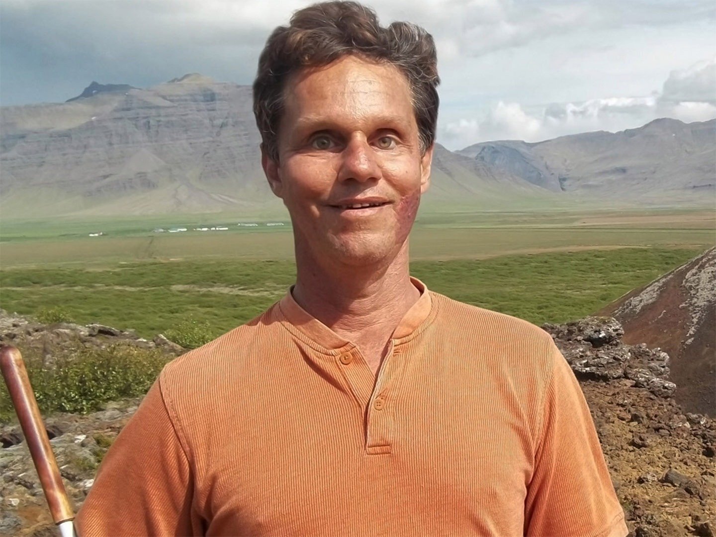 Series photo