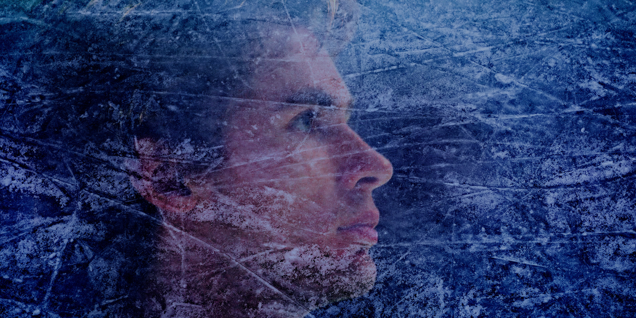 Series photo