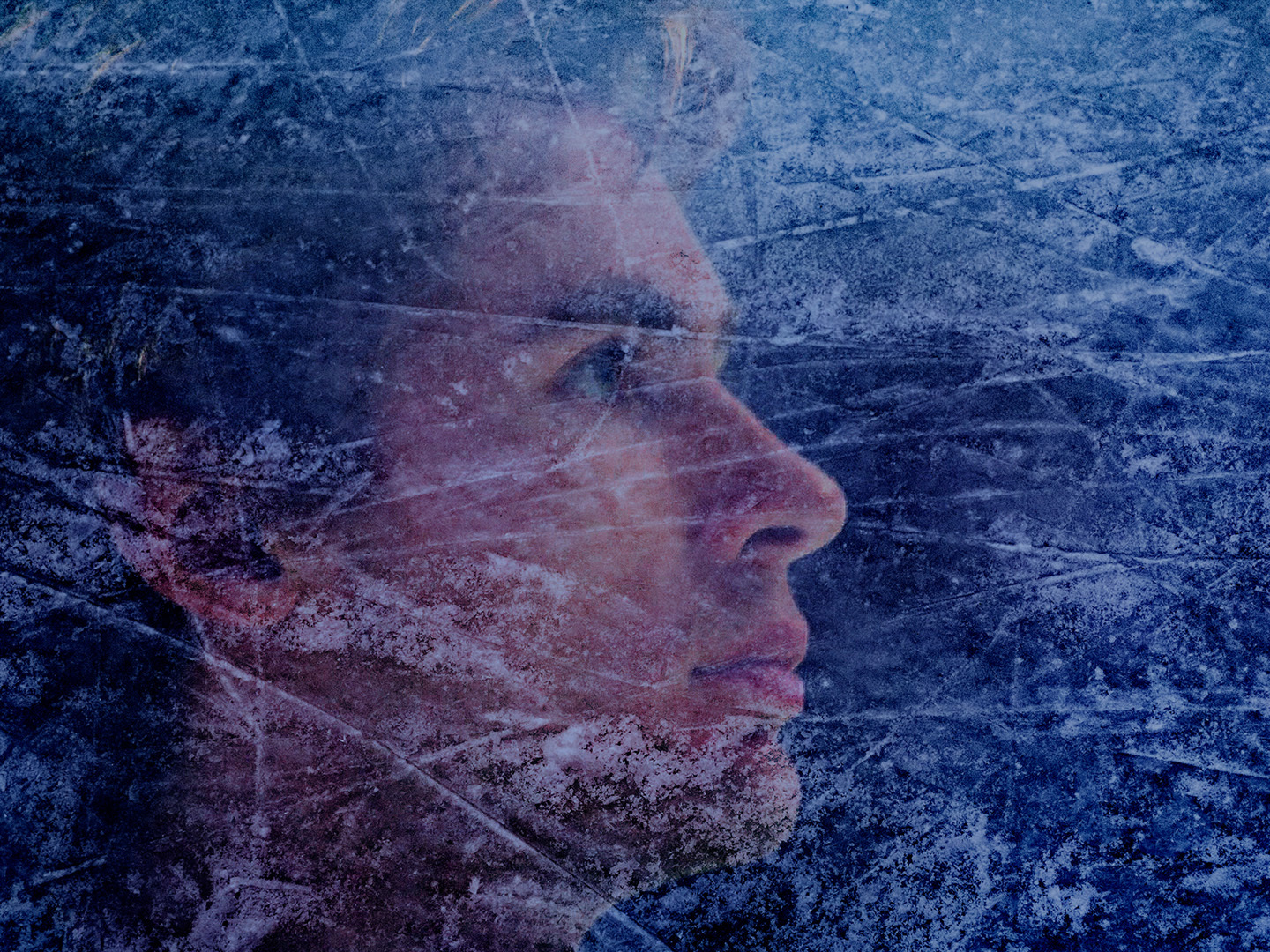 Series photo