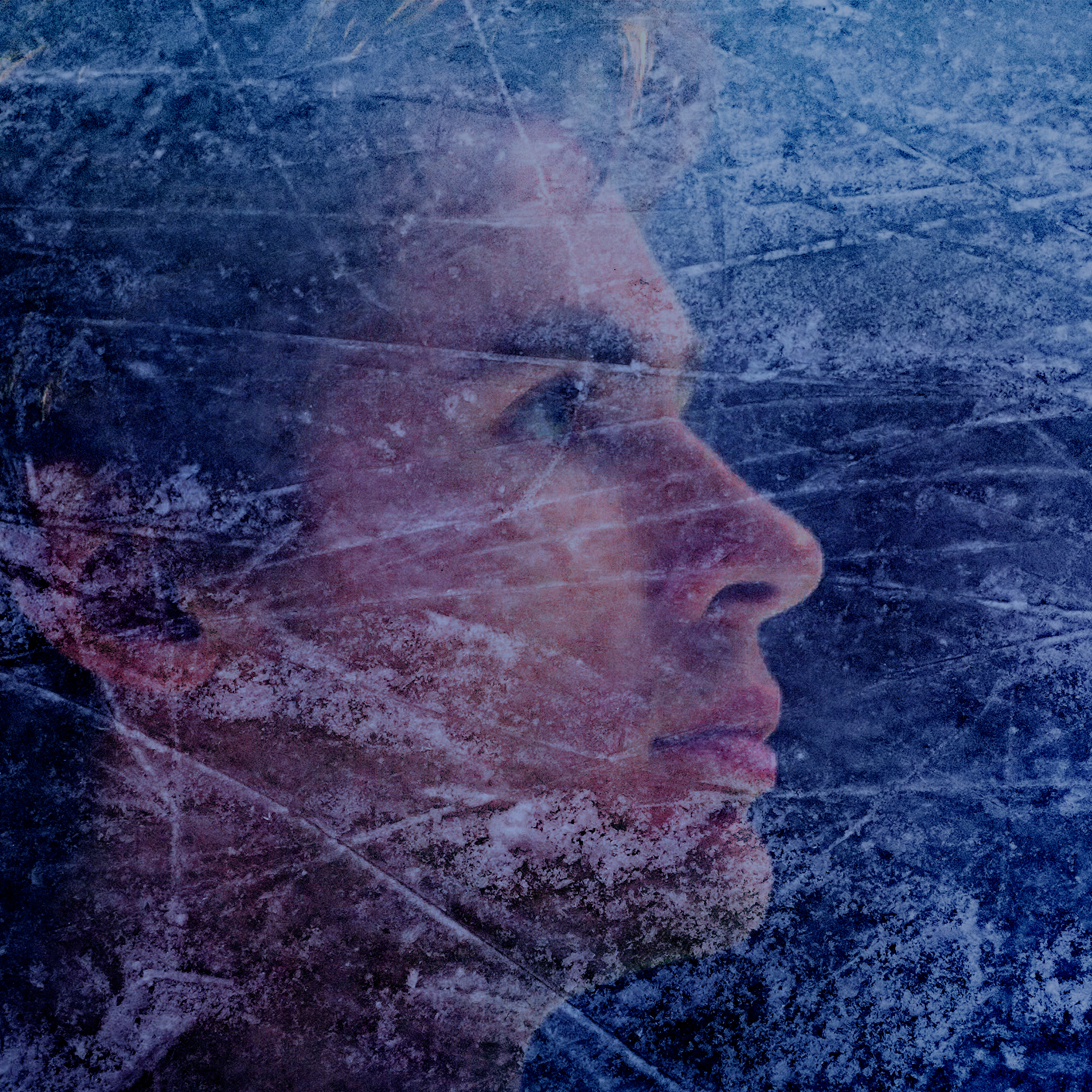 Series photo
