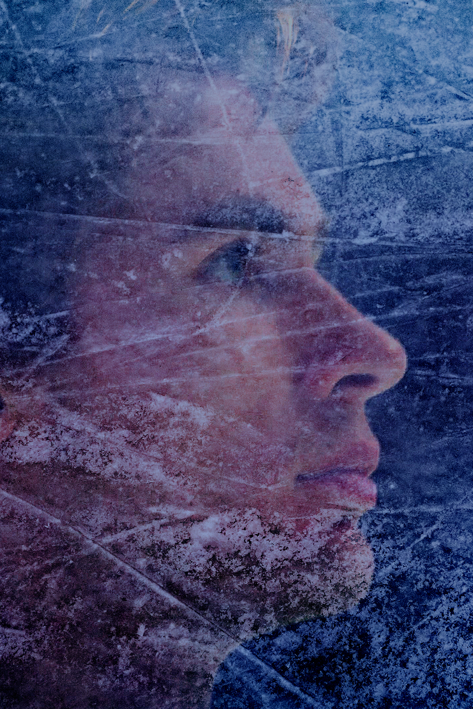 Series photo