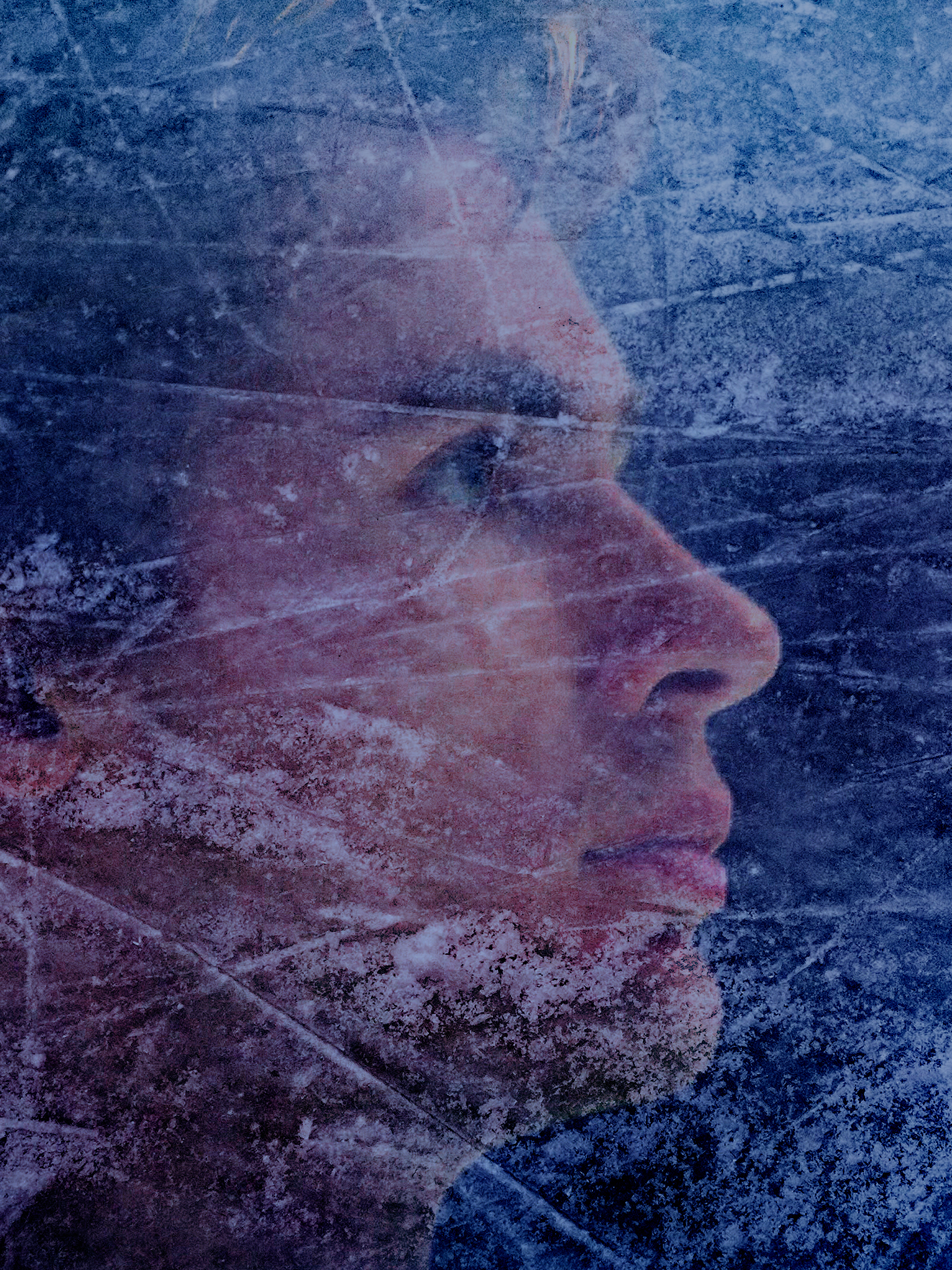 Series photo